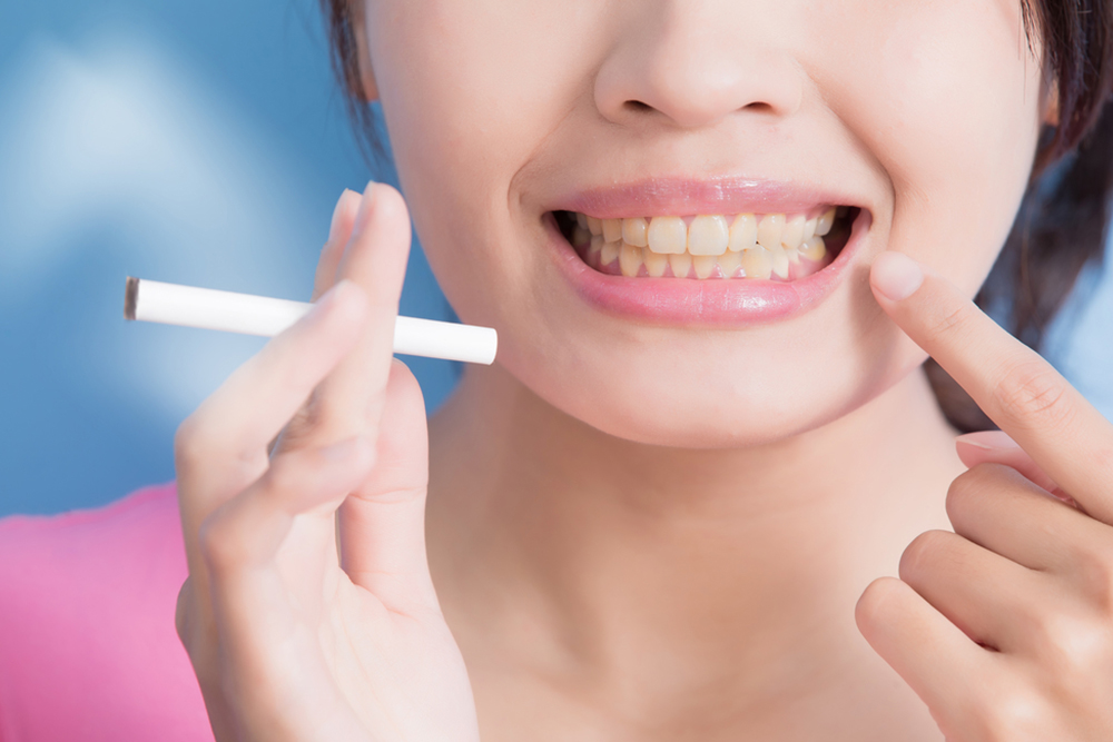 Hogyan befolyásolja a dohányzás a fogak